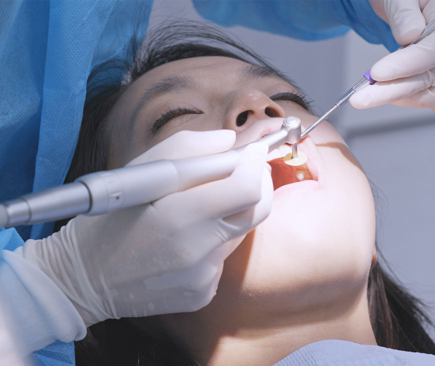 کاشت دندان - ایمپلنت دندان - کلینیک دندان پزشکی دکتر شمسایی