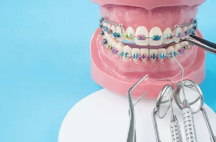 ارتودنسی دندان - دکتر زهرا شمسایی