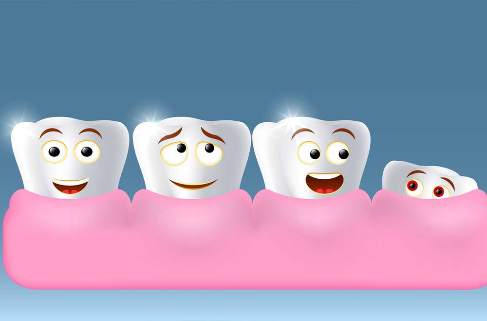 کشیدن دندان عقل - کلینیک دکتر زهرا شمسایی