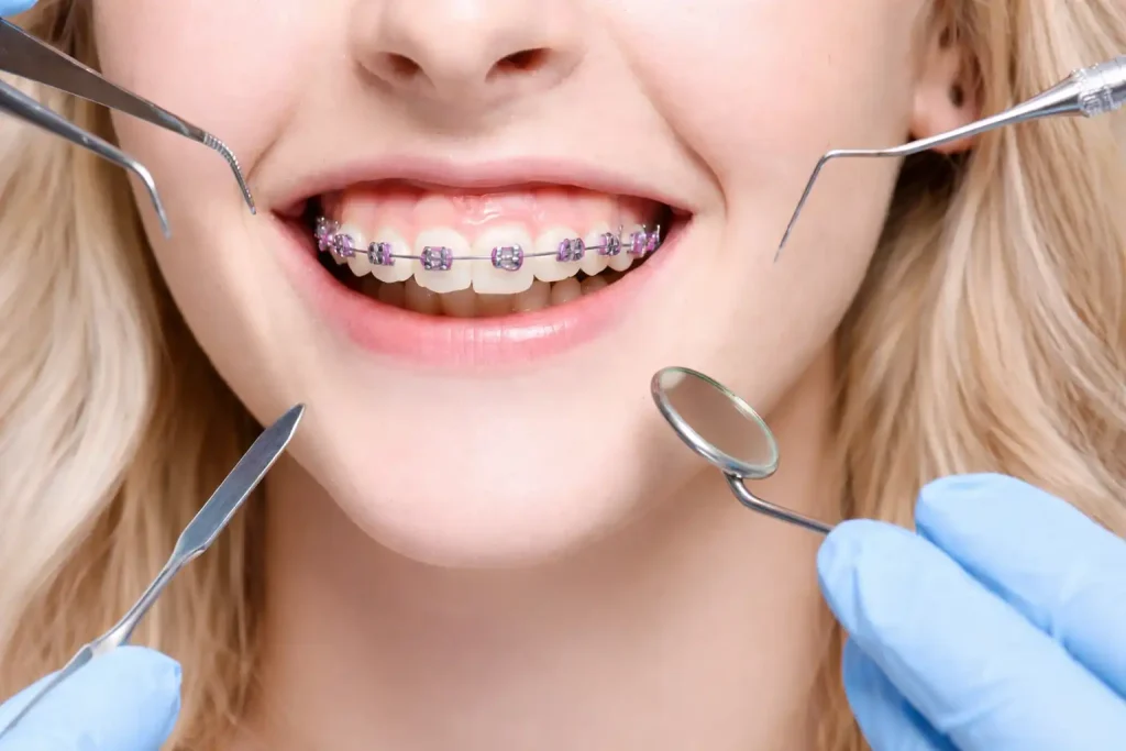 ارتودنسی دندان چیست