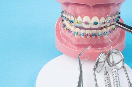 ارتودنسی دندان چیست - دندانپزشکی دکتر زهرا شمسایی