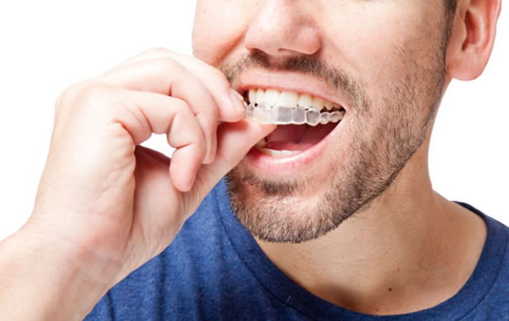 ارتودنسی دندان - کلینیک دندانپزشکی دکتر شمسایی 