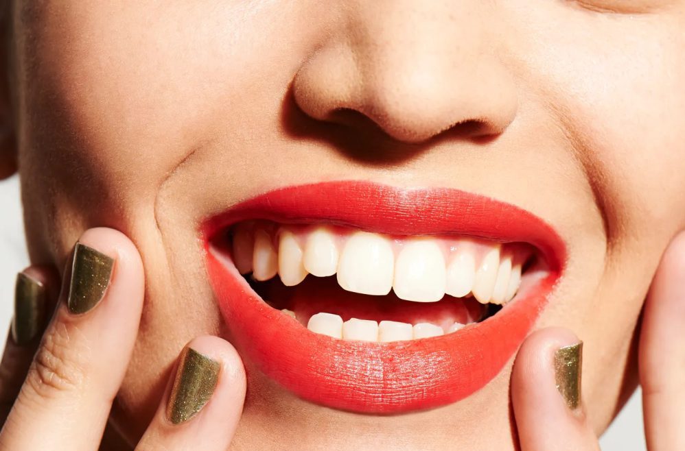 جرم گیری دندان - کلینیک دکتر زهرا شمسایی