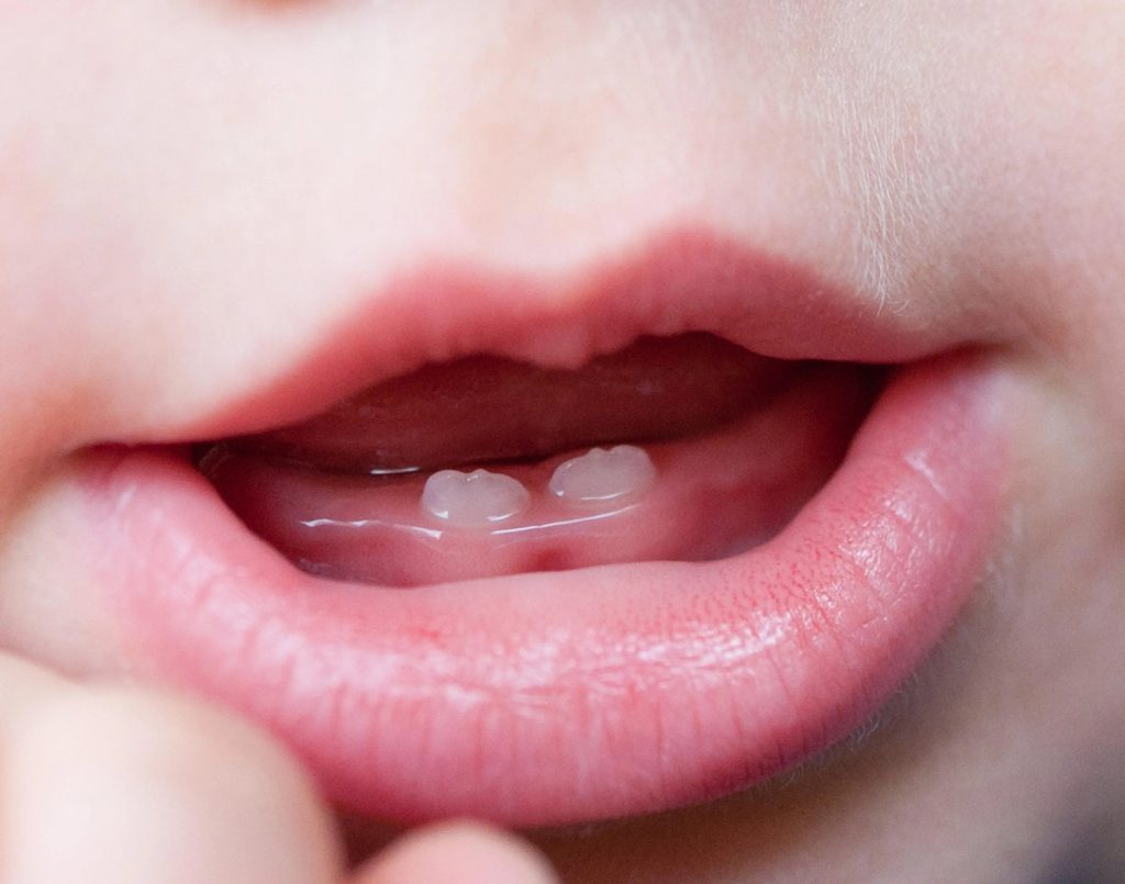 دندان شیری- کلینیک دکتر زهرا شمسایی