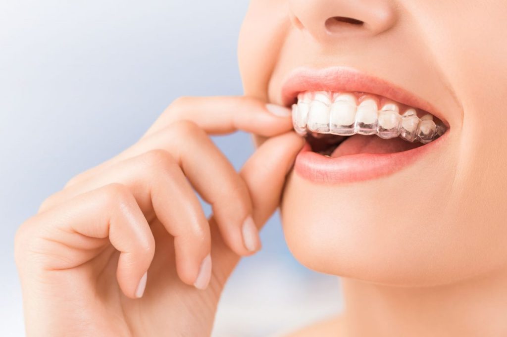 ارتودنسی دندان - کلینیک دندانپزشکی دکتر زهرا شمسایی