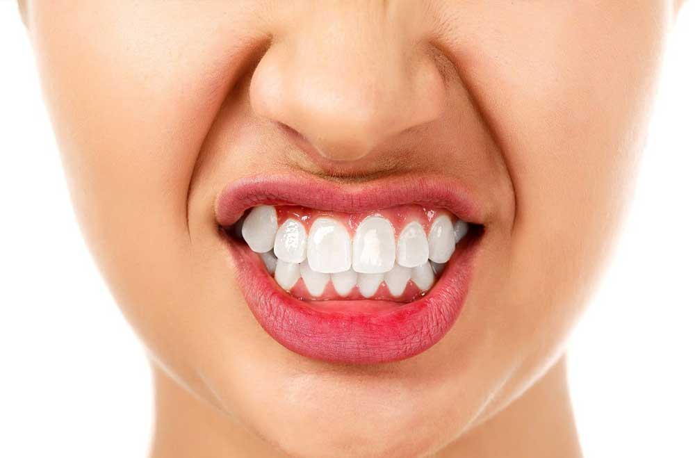 دندان قروچه چیست - دکتر زهرا شمسایی