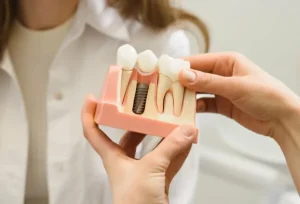 ایمپلنت فوری یا معمولی