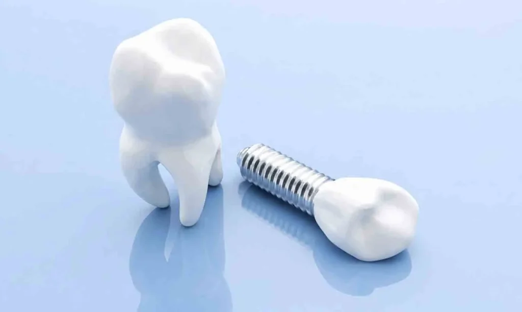 مزایا و معایب ایمپلنت دندان